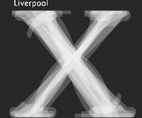 Liverpool X