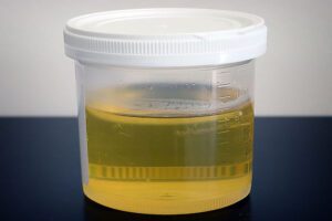 New device created to smell cancer in a man's urine. Pic © Wikimedia Commons